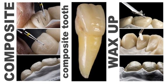 The Final Touch – Composite and Wax (On-Line Course)